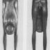 Thumbnail: Boy Looking through Legs, image 2